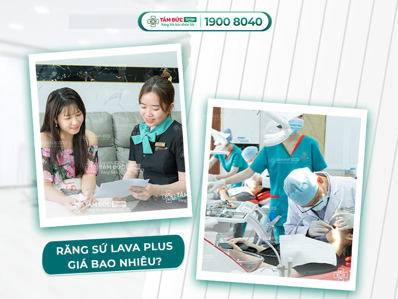 BẢNG GIÁ RĂNG SỨ LAVA PLUS 2025