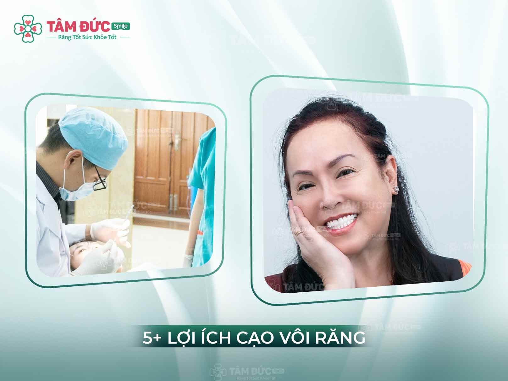 BẬT MÍ 5 LỢI ÍCH KHI CẠO CAO RĂNG VÀ QUY TRÌNH THỰC HIỆN CHUẨN Y KHOA