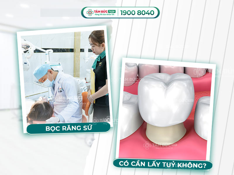 BỌC RĂNG SỨ CÓ CẦN PHẢI LẤY TỦY HAY KHÔNG?