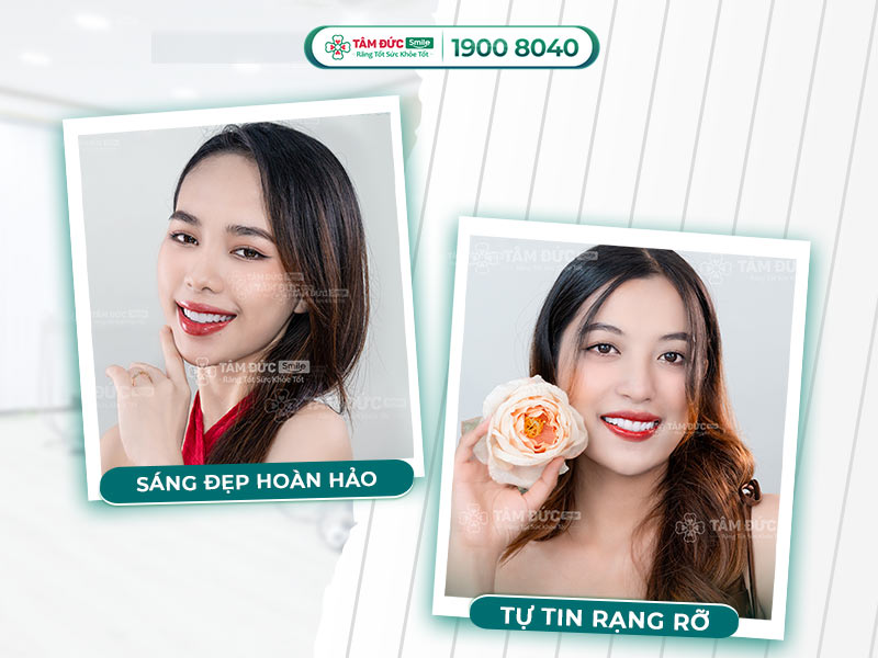 CÁC DÒNG SỨ CAO CẤP TẠI TÂM ĐỨC SMILE CÓ GÌ KHÁC NHAU