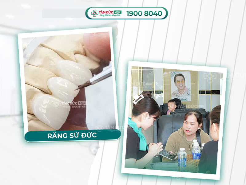 CÁC LOẠI RĂNG SỨ CỦA ĐỨC TỐT NHẤT HIỆN NAY