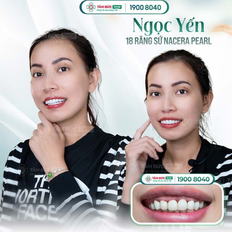 khách hàng làm răng phú quý tại nha khoa Tâm Đức Smile