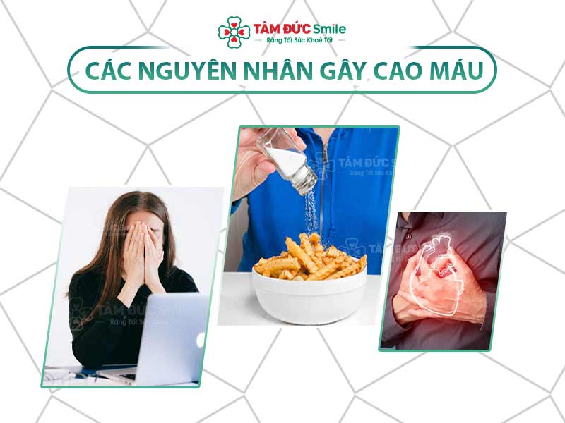 CAO MÁU LÀ GÌ? NGUYÊN NHÂN GÂY CAO MÁU VÀ 5+ CÁCH PHÒNG NGỪA