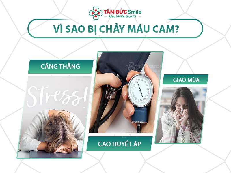 CHẢY MÁU CAM LÀ BỊ GÌ? CÁCH PHÒNG NGỪA CHẢY MÁU CAM HIỆU QUẢ