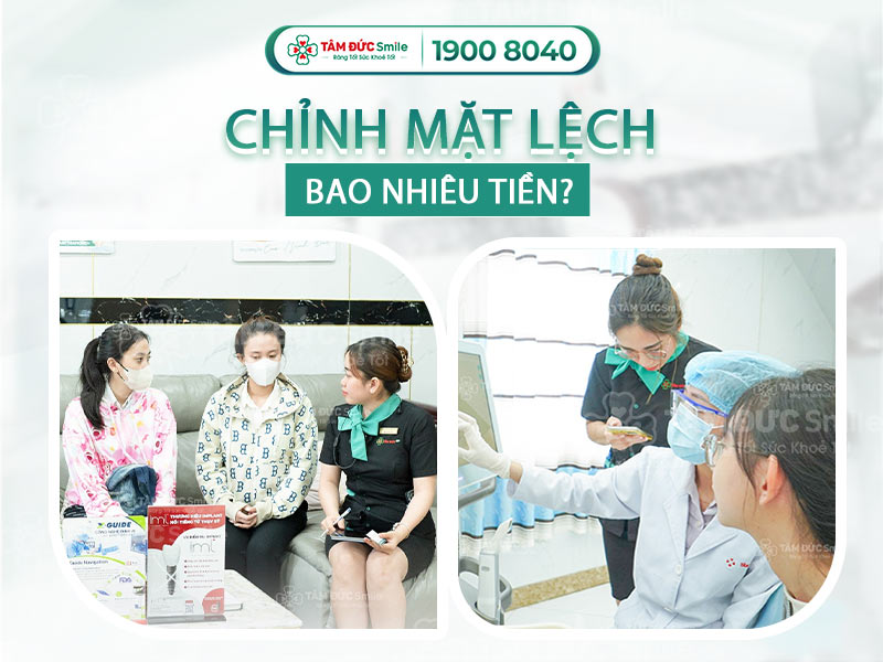 CHỈNH MẶT LỆCH GIÁ BAO NHIÊU? NHỮNG LƯU Ý QUAN TRỌNG KHI KHẮC PHỤC LỆCH MẶT