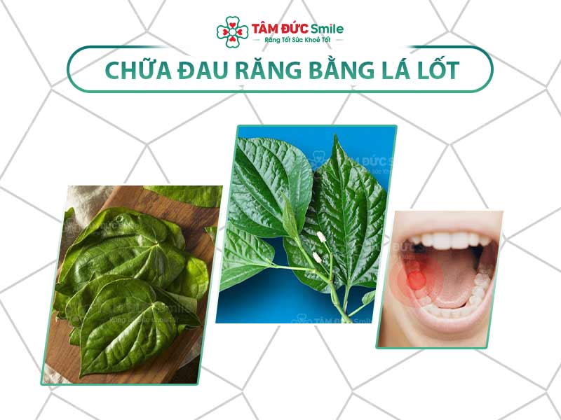 CHỮA ĐAU RĂNG BẰNG LÁ LỐT CÓ HIỆU QUẢ KHÔNG?