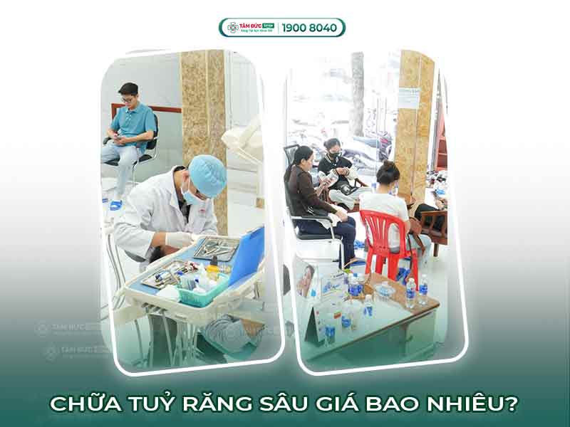 CHỮA TỦY RĂNG BỊ SÂU GIÁ BAO NHIÊU TIỀN HIỆN NAY?