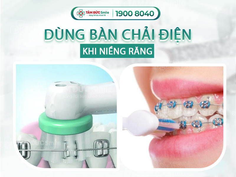 CÓ NÊN DÙNG BÀN CHẢI ĐIỆN KHI NIỀNG RĂNG KHÔNG? NHỮNG LƯU Ý QUAN TRỌNG