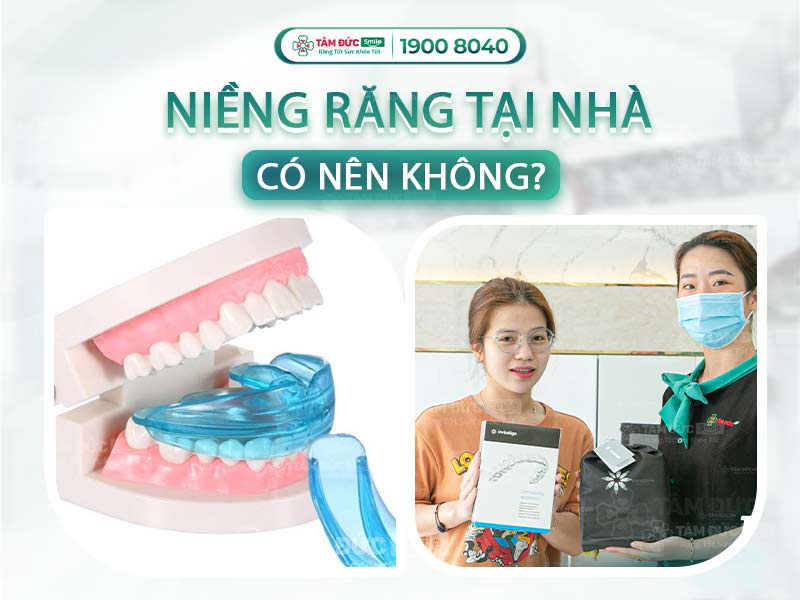 CÓ NÊN NIỀNG RĂNG TẠI NHÀ KHÔNG? NHỮNG ĐIỀU LƯU Ý KHI NIỀNG RĂNG TẠI NHÀ