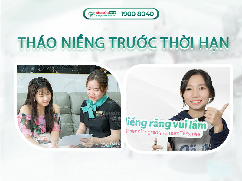 CÓ THỂ THÁO NIỀNG RĂNG TRƯỚC THỜI HẠN ĐƯỢC KHÔNG?