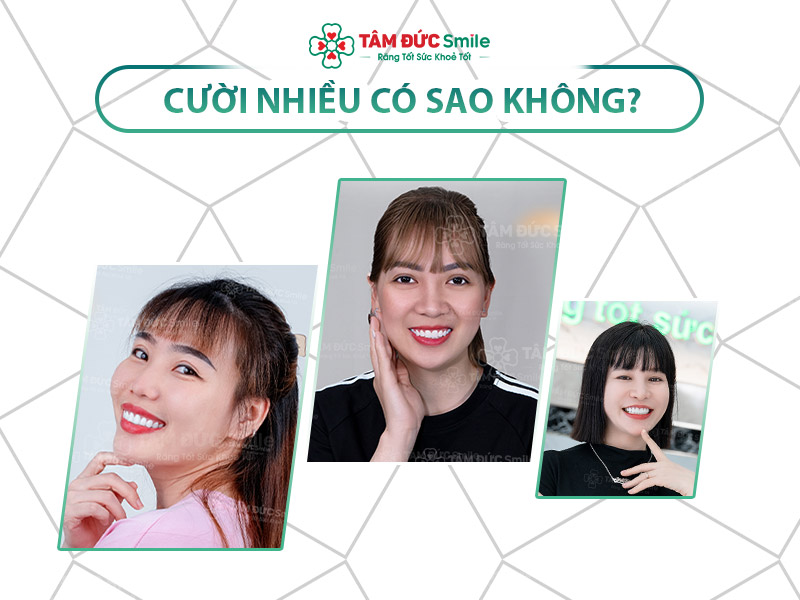 CƯỜI NHIỀU CÓ SAO KHÔNG? TÁC HẠI KHI CƯỜI QUÁ NHIỀU