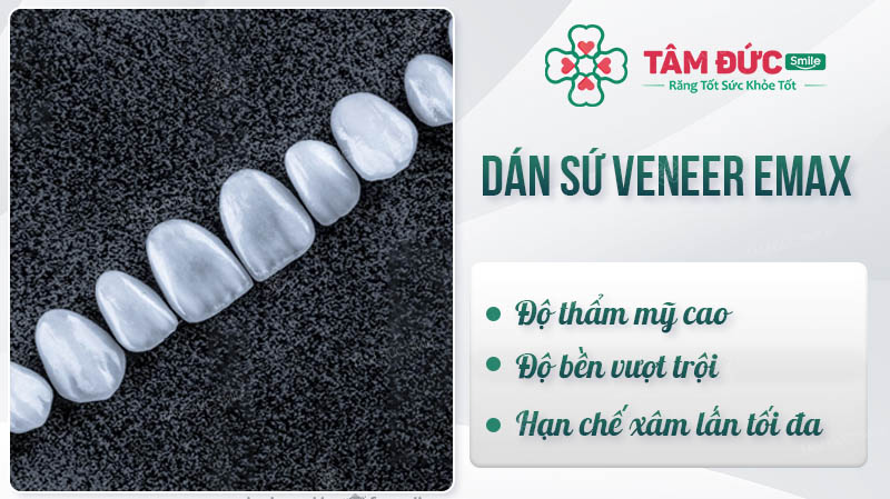 DÁN SỨ VENEER EMAX - TỎA SÁNG NỤ CƯỜI, RẠNG NGỜI KHÍ CHẤT