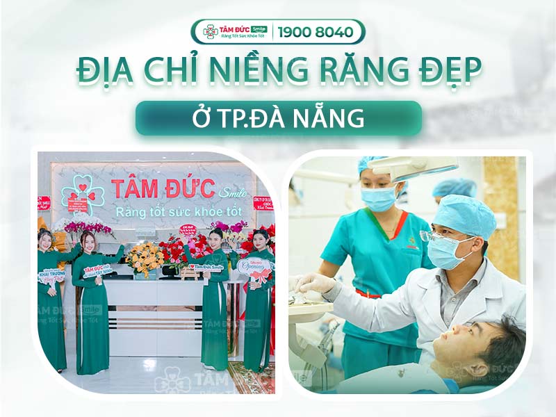 ĐỊA CHỈ NIỀNG RĂNG CHẤT LƯỢNG HIỆU QUẢ TẠI ĐÀ NẴNG TRỌN GÓI 10.000.000 VNĐ/HÀM