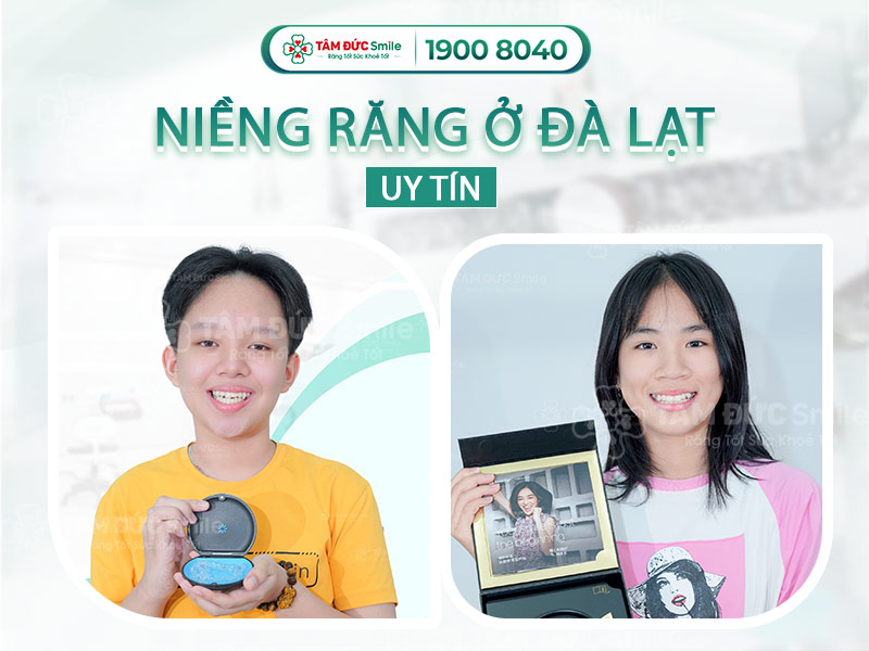 ĐỊA CHỈ NIỀNG RĂNG Ở ĐÀ LẠT UY TÍN, TRẢ GÓP 0% LÃI SUẤT TRẢ TRƯỚC 1 TRIỆU