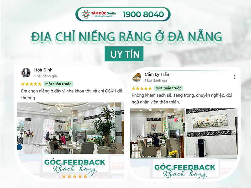 ĐỊA CHỈ NIỀNG RĂNG Ở ĐÀ NẴNG UY TÍN, CHỈ TỪ 10 TRIỆU/HÀM, TRẢ TRƯỚC 1 TRIỆU, LÃI SUẤT 0%