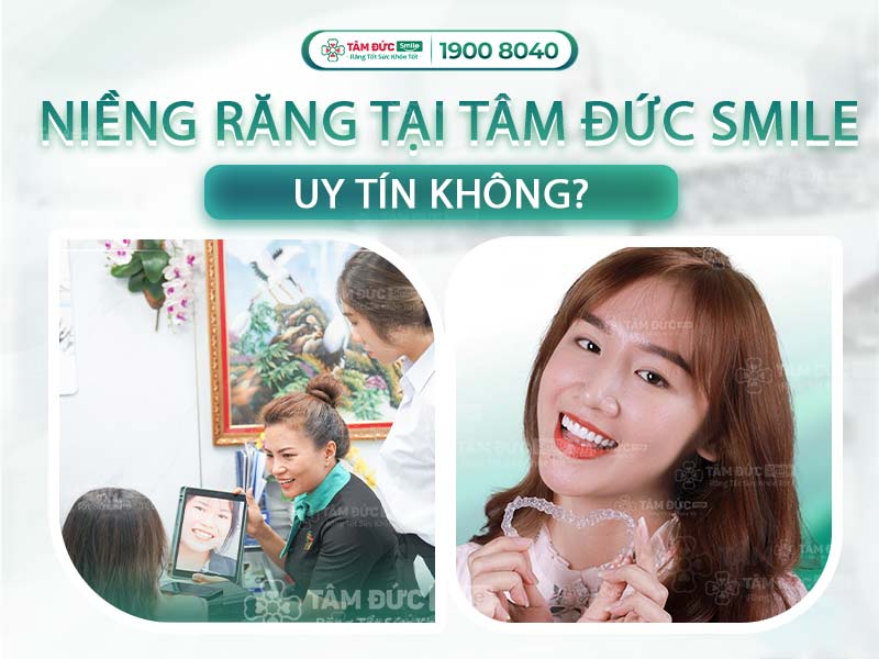 NIỀNG RĂNG Ở TPHCM - VÌ SAO NÊN LỰA CHỌN NHA KHOA TÂM ĐỨC SMILE?