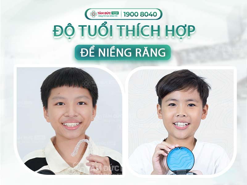 ĐỘ TUỔI THÍCH HỢP ĐỂ NIỀNG RĂNG | HỆ THỐNG NHA KHOA CÔNG NGHỆ HIỆN ĐẠI