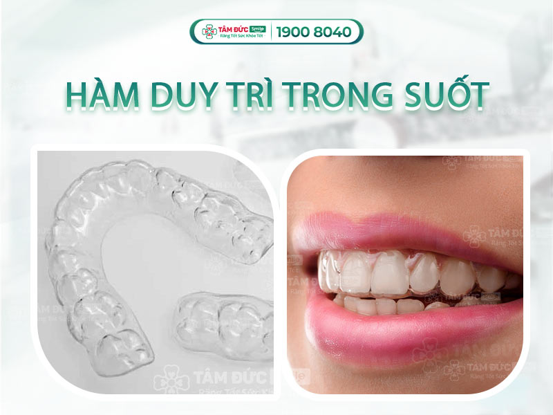 [GIẢI ĐÁP] HÀM DUY TRÌ TRONG SUỐT GIÁ BAO NHIÊU?