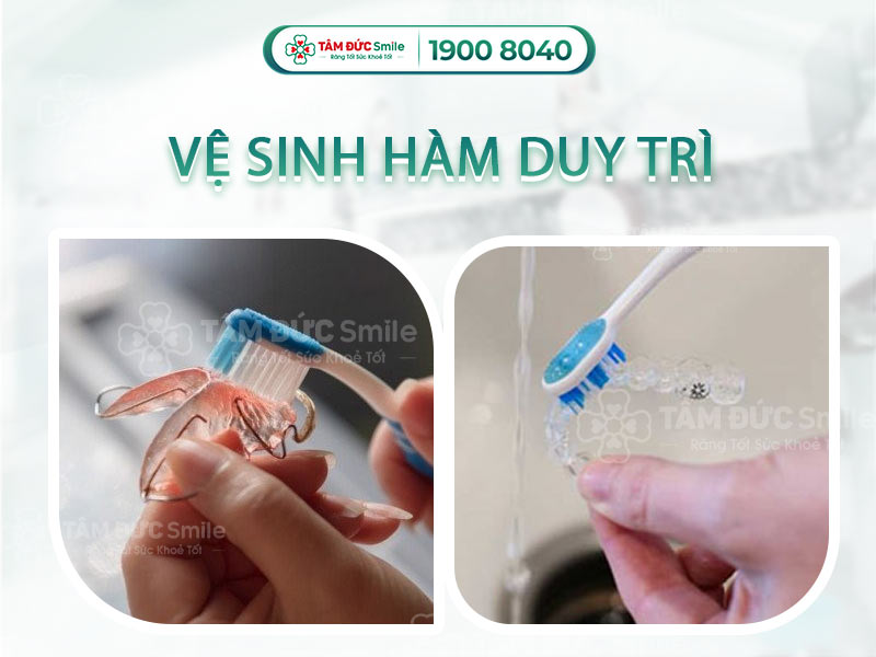 HƯỚNG DẪN CÁCH VỆ SINH HÀM DUY TRÌ TRONG SUỐT TẠI NHÀ