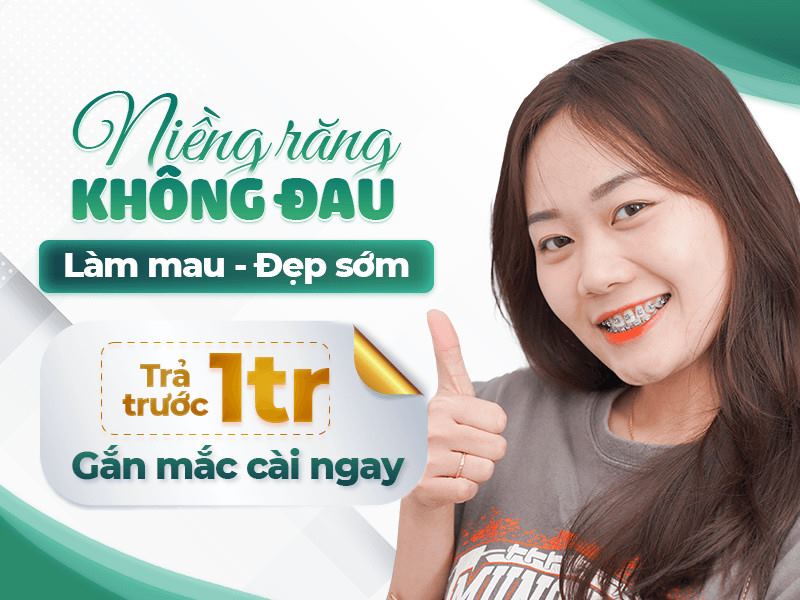 KIẾN TẠO NỤ CƯỜI - NIỀNG RĂNG TRỌN GÓI 10.000.000 VNĐ/HÀM