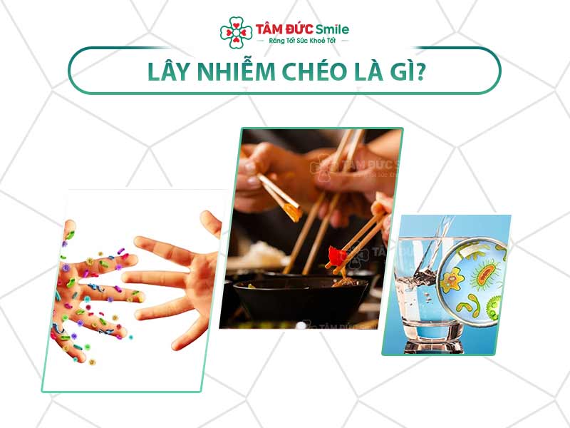 LÂY NHIỄM CHÉO LÀ GÌ? CÁCH TRÁNH LÂY NHIỄM CHÉO KHI KHÁM RĂNG