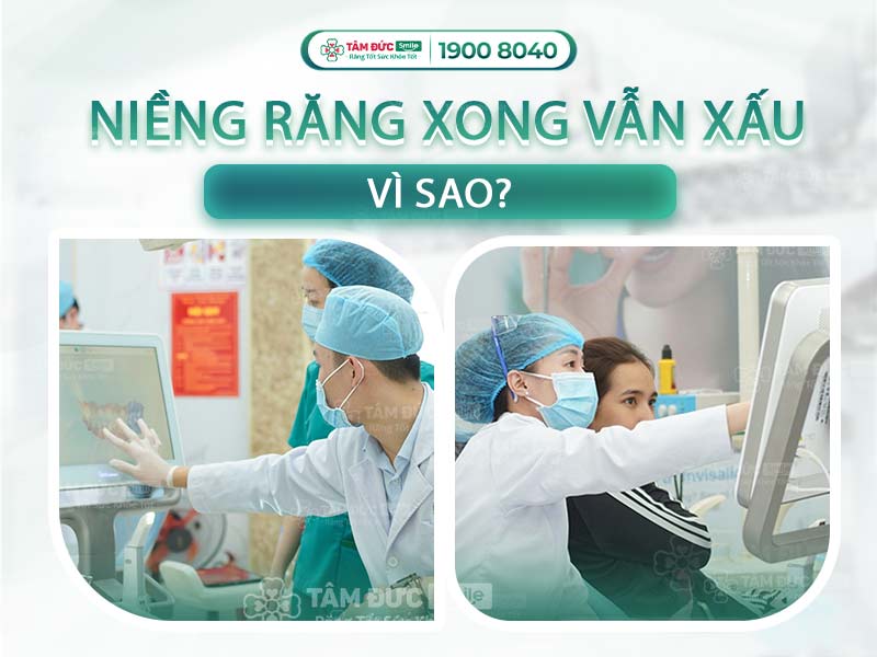 TOP 5 LÝ DO NIỀNG RĂNG XONG VẪN XẤU VÀ GIẢI PHÁP KHẮC PHỤC TIẾT KIỆM