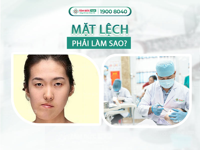 MẶT LỆCH PHẢI LÀM SAO? NHỮNG CÁCH KHẮC PHỤC MẶT LỆCH