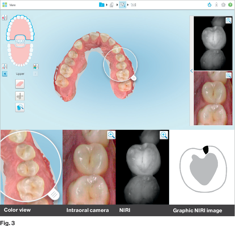 Máy CT Cone beam 3D