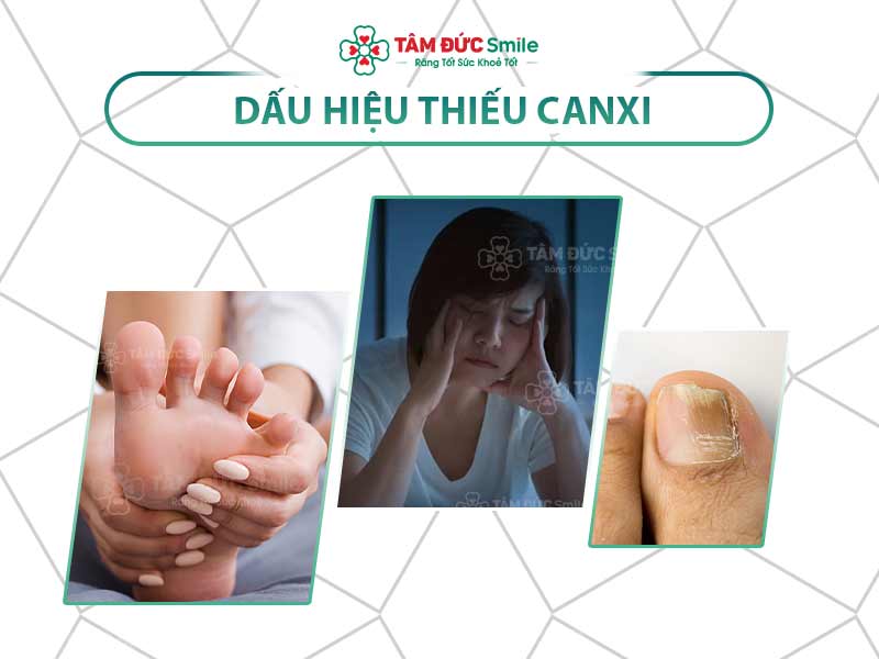 NHẬN BIẾT NHANH CÁC DẤU HIỆU THIẾU CANXI VÀ CÁCH KHẮC PHỤC