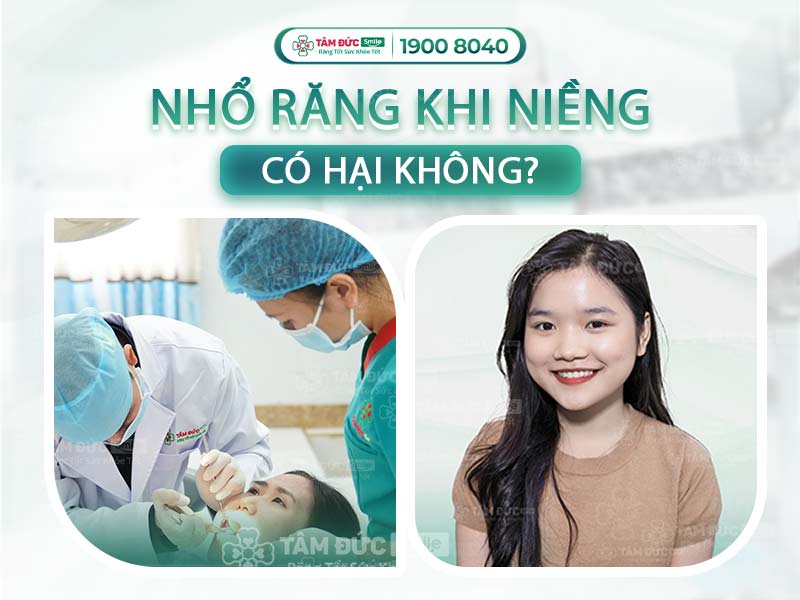 NHỔ RĂNG KHI NIỀNG CÓ HẠI KHÔNG? 4 GIẢI PHÁP THAY THẾ NHỔ RĂNG