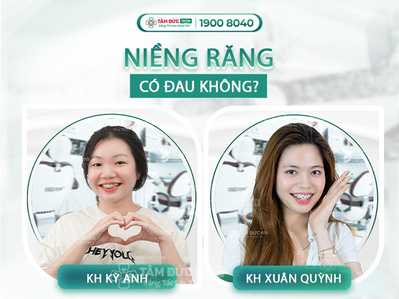 NIỀNG RĂNG CÓ ĐAU KHÔNG? GIÁ BAO NHIÊU VÀ THỜI GIAN BAO LÂU?