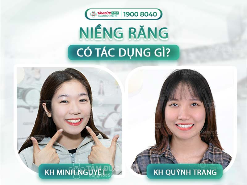 NIỀNG RĂNG CÓ TÁC DỤNG GÌ? TOP 7 LỢI ÍCH VƯỢT TRỘI NIỀNG RĂNG ĐEM LẠI