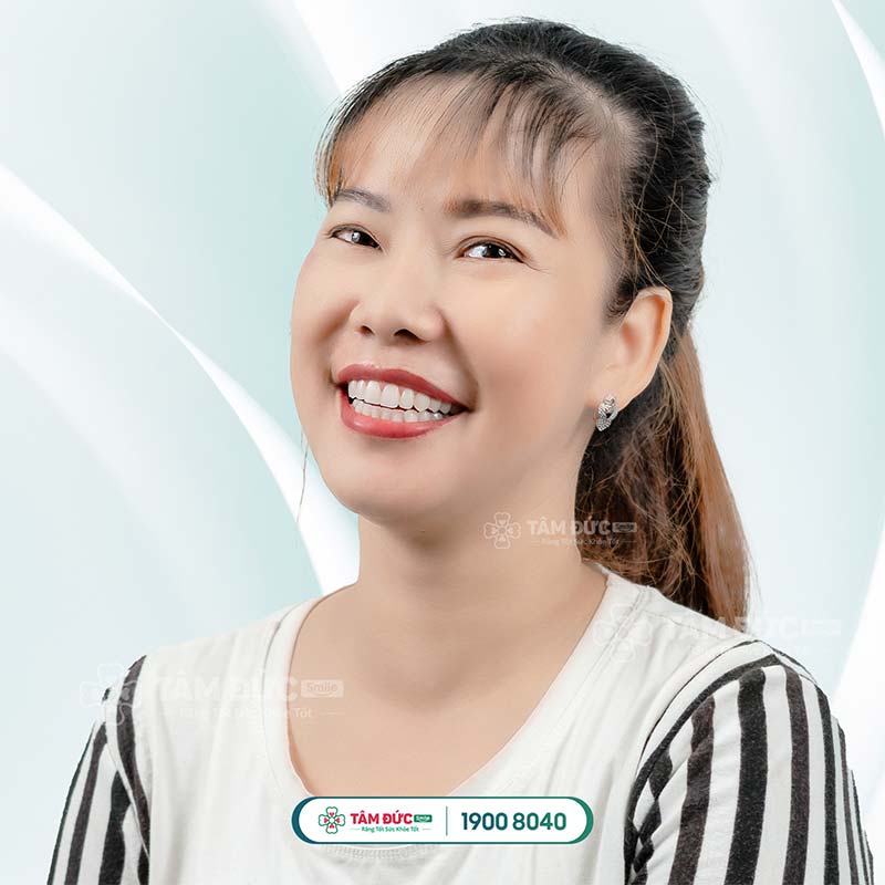 khách hàng bọc răng sứ tại nha khoa Tâm Đức Smile