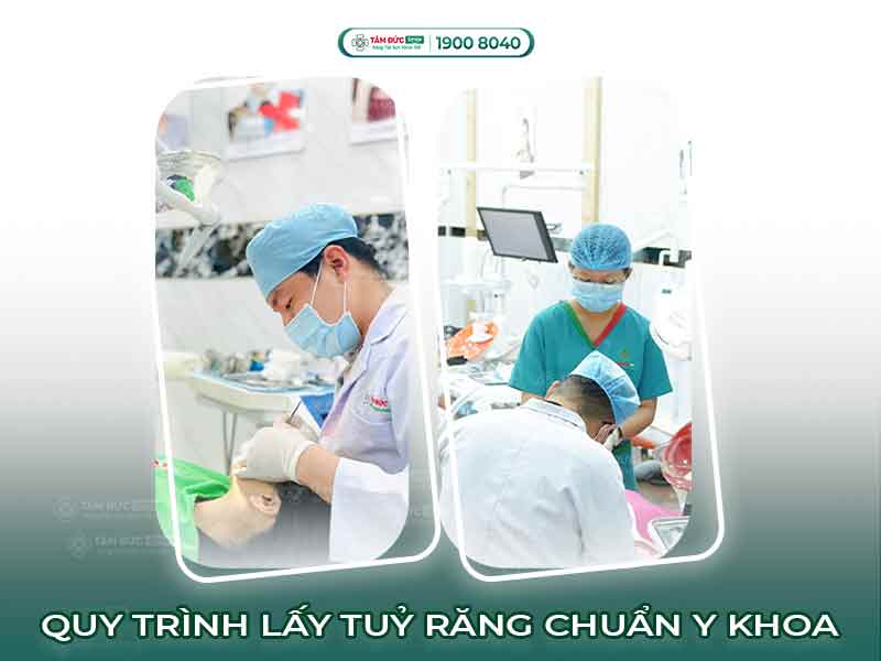 QUY TRÌNH LẤY TUỶ RĂNG CHUẨN Y KHOA AN TOÀN VÀ KHÔNG ĐAU