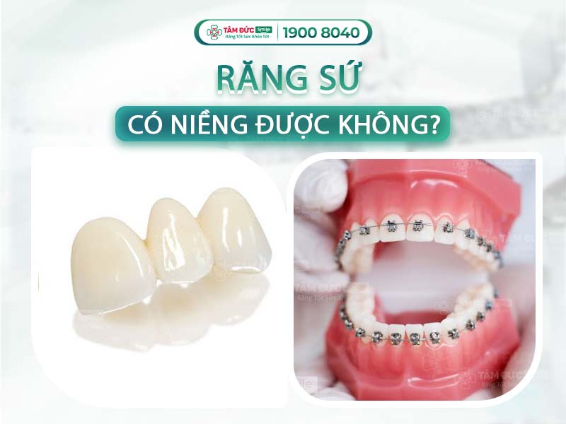 RĂNG SỨ CÓ NIỀNG ĐƯỢC KHÔNG? TRƯỜNG HỢP CÓ THỂ CÂN NHẮC ĐỂ NIỀNG RĂNG SỨ