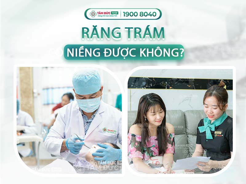 RĂNG TRÁM CÓ NIỀNG ĐƯỢC KHÔNG? CƠ SỞ NIỀNG RĂNG UY TÍN