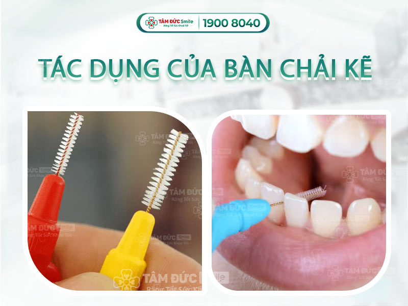 TÁC DỤNG CỦA BÀN CHẢI KẼ RĂNG TRONG VIỆC LÀM SẠCH KHOANG MIỆNG 