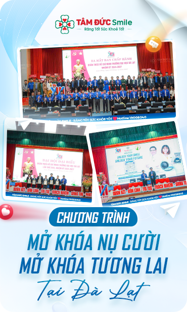 MỞ KHOÁ NỤ CƯỜI TẠI ĐÀ LẠT