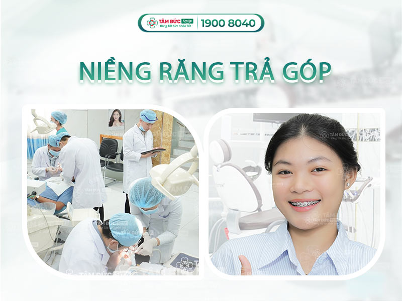 THÁNG ƯU ĐÃI NIỀNG RĂNG - NIỀNG RĂNG TRẢ GÓP LÃI SUẤT 0%