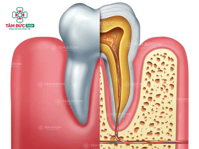 tuỷ răng màu gì