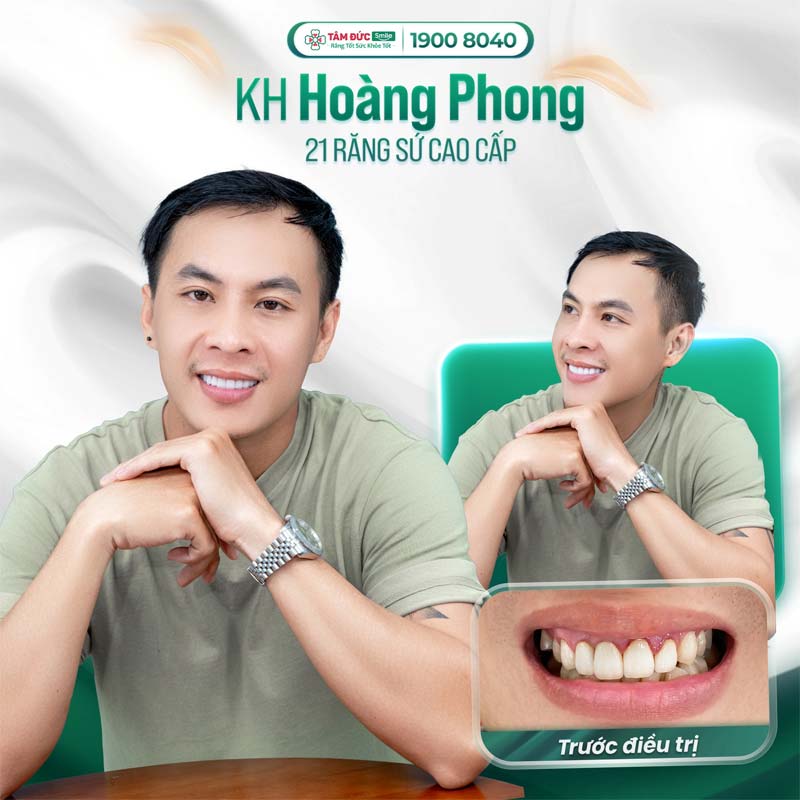 khách hàng làm răng sứ tại nha khoa Tâm Đức Smile