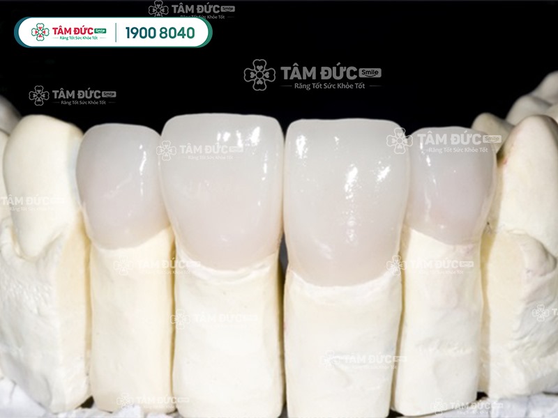 Ưu điểm răng toàn sứ zirconia là gì?