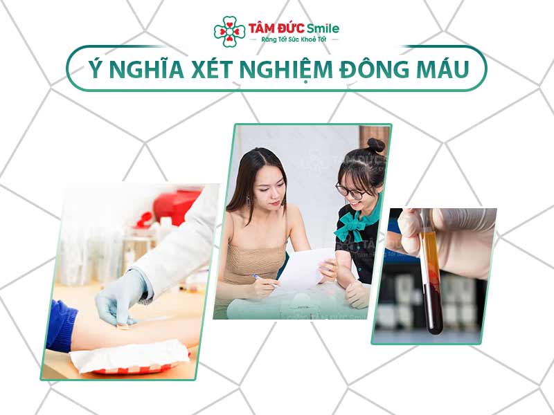 Ý NGHĨA XÉT NGHIỆM ĐÔNG MÁU TRONG ĐIỀU TRỊ BỆNH